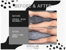 ステラー(STELLAR)/ビフォーアフター
