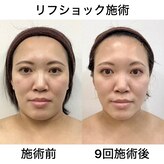 サンスタイルクリア 守山店(SUN STYLE CLEAR)