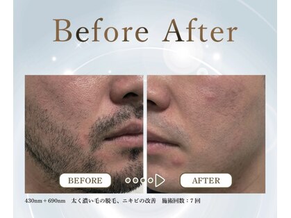 レリ ビューティラボ(Reli Beauty Lab)の写真