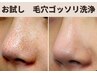 【毛穴ケア試してみたい方】毛穴ケアで黒ずみ角栓をごっそり除去して即綺麗