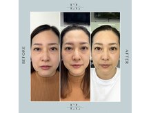 トータルビューティーサロンシーズン(Toral Beauty salon SEASON)