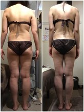 シャンティ 佐倉店(Shanti)/お客様の成果（1）