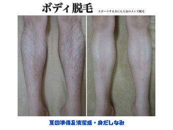 プリマプリート メンズ店/メンズ脱毛