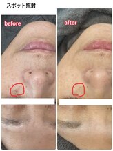 サロンドティアラ(Salon de Tiara)/フォト＋スポット照射