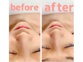 アンリール 苫小牧店(ANRIRE)/フェイシャル施術のお客様です