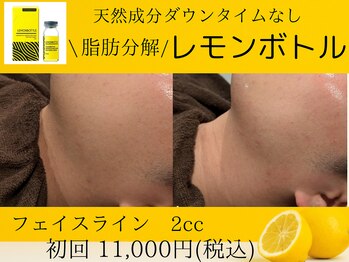 美々庵/レモンボトル/小顔/ブライダル