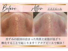 リーズリアン(Rises Lien)/【BeforeAfter】アクアピール