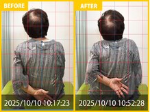 整体院 元 宇城松橋店/下肢の痺れの悩み