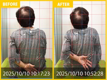 整体院 元 宇城松橋店/下肢の痺れの悩み