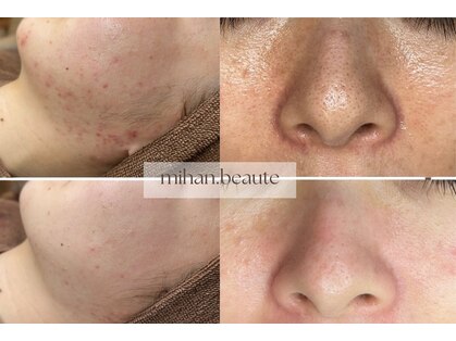 ミハン ボーテ(mihan.beaute)の写真