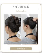 ミース 上野店/うなじの悩みを解消！