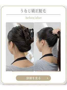 ミース 上野店/うなじの悩みを解消!