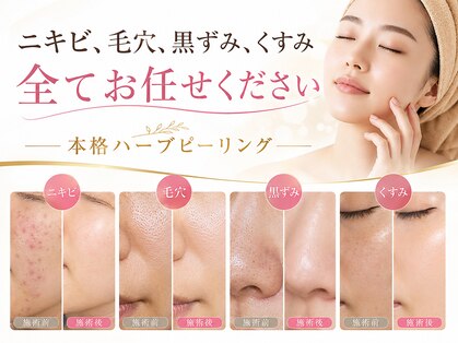 メルヴェイユの写真