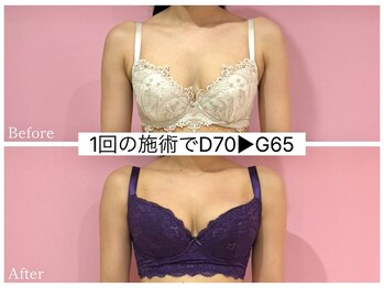 ククナ 新潟本店(KUKUNA)/*バストアップケア*