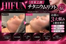 ハイフン(HIFUN)