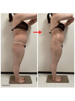 エムエー(ma)/パワーレメディ全身120分