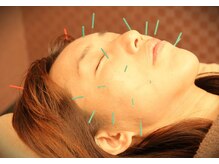 エルドラード(EL DORADO)/美容鍼灸