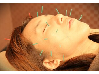 エルドラード(EL DORADO)/美容鍼灸