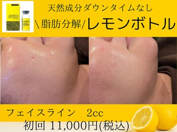 美々庵/レモンボトル/小顔/ブライダル