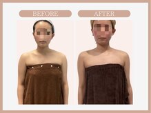 スリムライン 仙台店(The Slim Line)/before→after