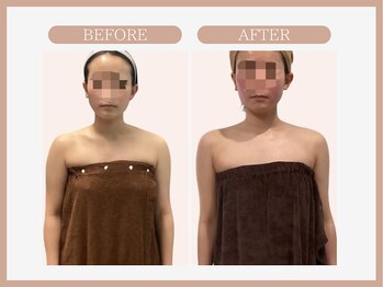 スリムライン 仙台店(The Slim Line)/before→after