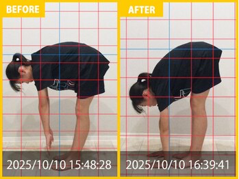 整体院 元 宇城松橋店/腰痛の悩み
