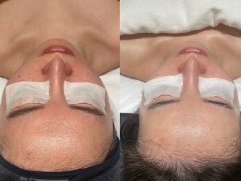 フロムミー 銀座本店(FROM ME)/バイオヒール