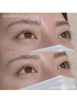 ノースポール(north pole)/メーテルラッシュリフト