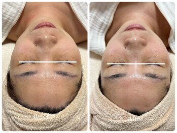 コア(Coeur)/黄ぐすみ、たるみ、しわを改善