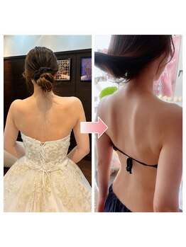 ビルーチェ(美LUCE)の写真/【骨格&骨盤専門】ドレス姿で気になる肩の高さの違い・巻肩・猫背改善◎軽やかな天使の羽で美しい後ろ姿
