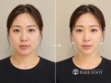 ベアフット(BARE FOOT)/自然体の美しさ