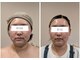 イチグラム(Ichi Glam)の写真/とことん結果にこだわる！ハンド×最新マシンで根本改善を目指したい方☆