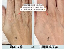 グロウ センター南(GLOW)の雰囲気（エステでしみシワたるみを改善！リンパを流してむくみスッキリ☆）