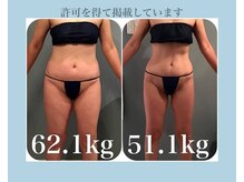 ボディエステティック アクアオーラ 高岡店/163センチ / 50代