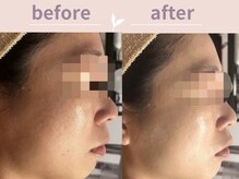 アール(R)/くすみが気になるお肌に！