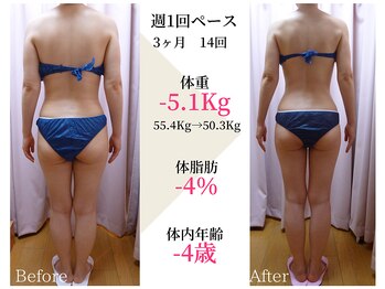 ベルタ 仙台店(BELTA)/【ケア前→後】2ヶ月で-5.1キロ