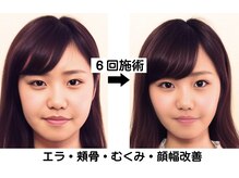 ニュートラル 渋谷店(NEUTRAL)/小顔矯正結果［小顔/骨盤］