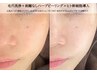 人気メニュー組合【すべてのお悩みに】毛穴洗浄&ハーブ&ヒト幹細胞導入¥18700