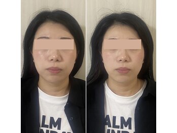 サロン ウェル(SALON WELL)/【30代 小顔/たるみケア】