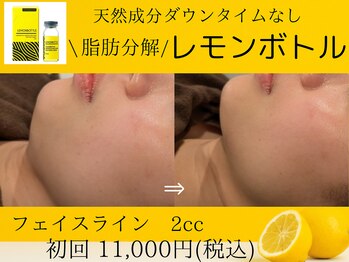 美々庵/レモンボトル/小顔/ブライダル