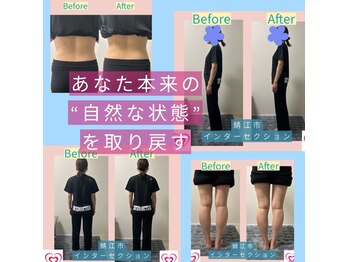 腰の整体インターセクション