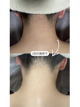 ロキュンプ(Rocyump)/効果重視の方も納得して頂ける