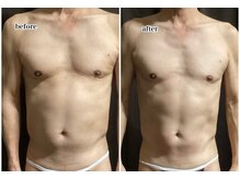 ヴィー(VII)/気になるお腹周り集中メンズ痩身