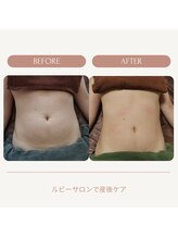 ルビーサロン(ruby-salon)/
