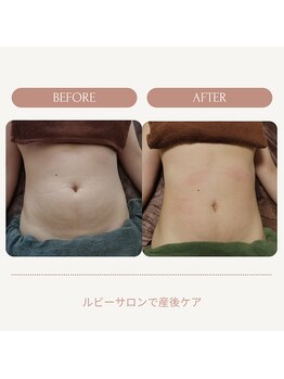 ルビーサロン(ruby-salon)/