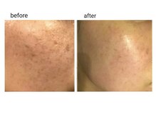 エステ デ アイリス(Esthe de Iris)/スポンジアトリートメント