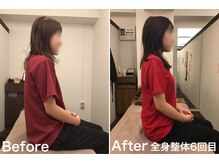 整体えびす丸 三軒茶屋店/巻き方改善！姿勢美人へ！