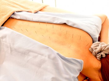 シュハリ(SHUHaRi)/鍼施術