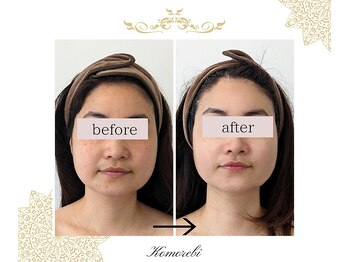 コモレビ(Komorebi)/