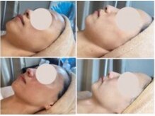 エスビューティー 三軒茶屋(S beauty)/たるみ・池尻大橋・痩身